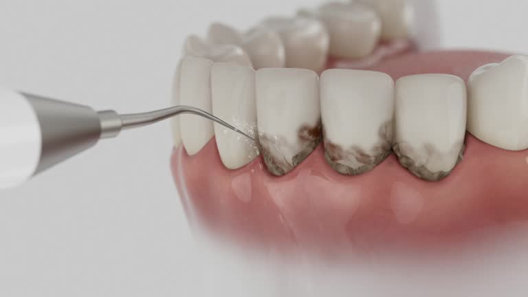 Trusted Root Canal Treatment service in Owenton, KY - Dentist Open Now